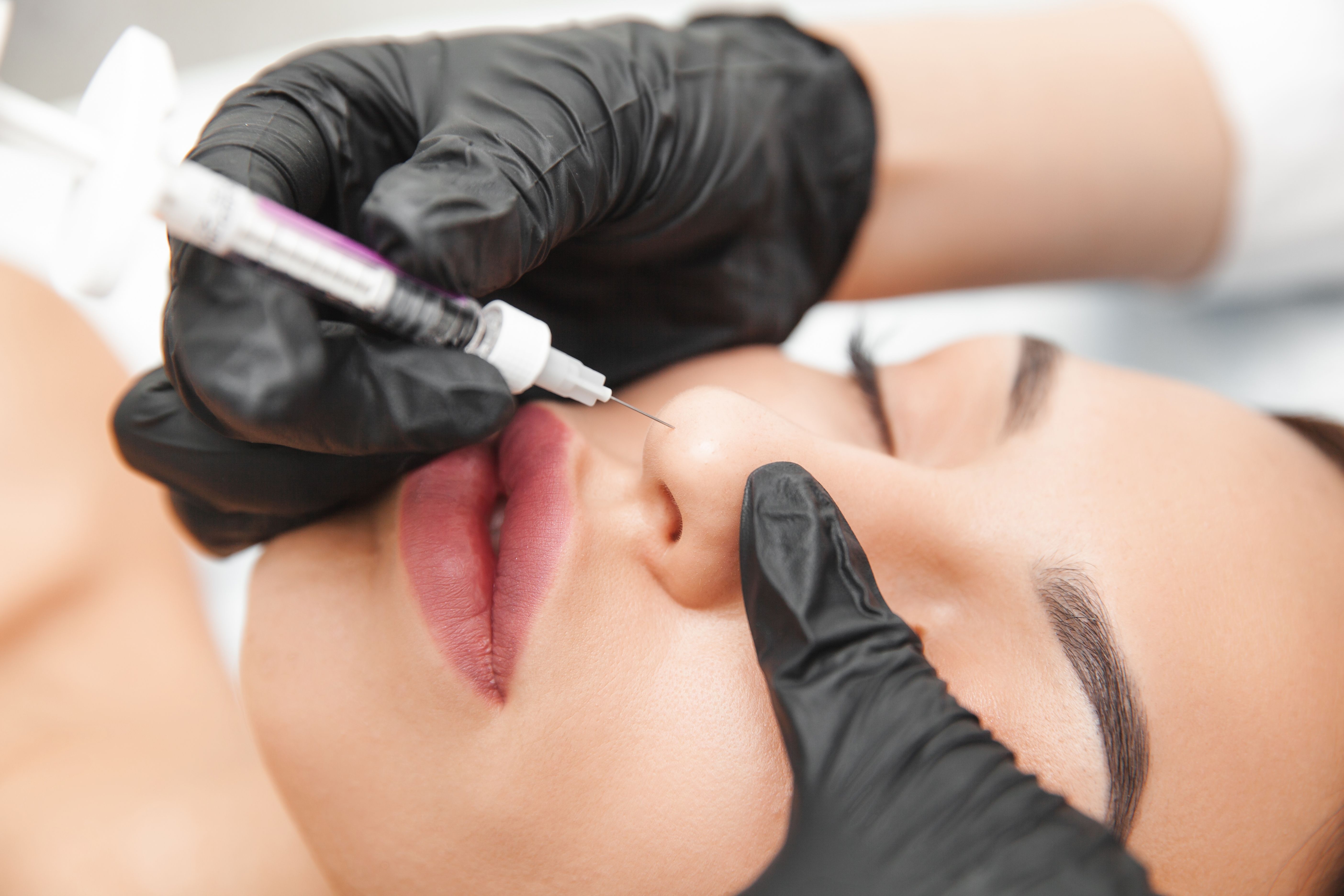 nose filler.jpg
